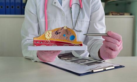 Doktor drži anatomski model i pokazuje moguću tumorsku promenu na dojci