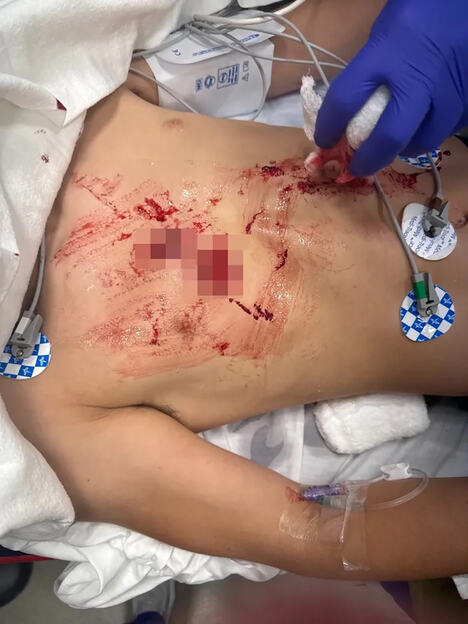 savage-attack-boy-13-brutally-1108803202.jpg