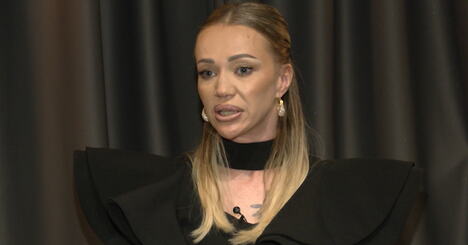 influenserka Kristina Kika Živković u studiju Kurir televizije govori o posledicama napada bivšeg partnera
