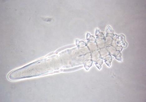 demodex-folliculorum.jpg