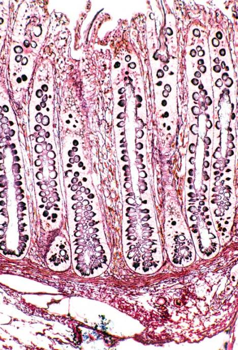 creva-virus-stomak.jpg