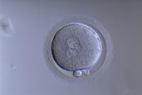 abortus-beba.jpg