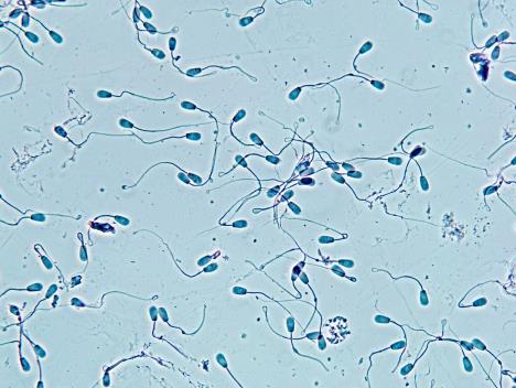 sperma-spermatozoidi.jpg