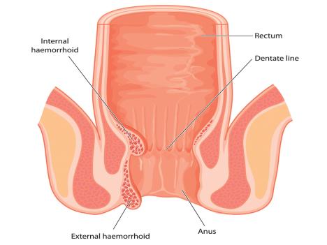 slika-anus.jpg