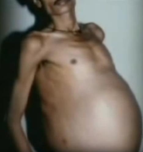 muskarac-fetus-foto-youtube-printscreen.jpg