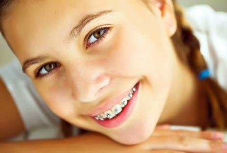 stockphotoportraitofteengirlshowingdentalbraces486598585.jpg