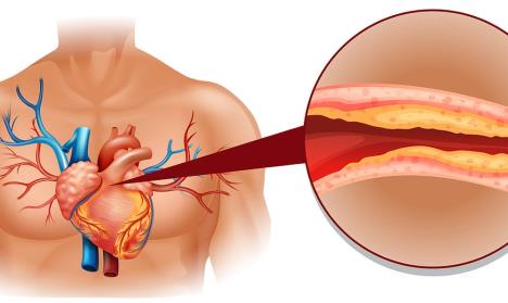 holesterol-shutterstock.jpg