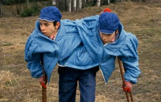 Maša i Daša Krivošljopova - sijamske bliznakinje