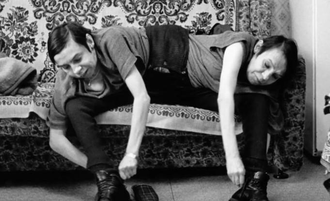 Maša i Daša Krivošljopova - sijamske bliznakinje