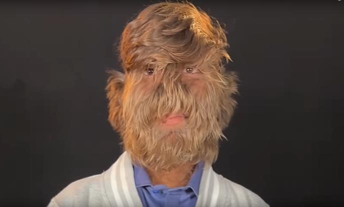 2025-03-12 08_11_24-(1) Hairiest Face - Guinness World Records - YouTube — Mozilla Firefox.png