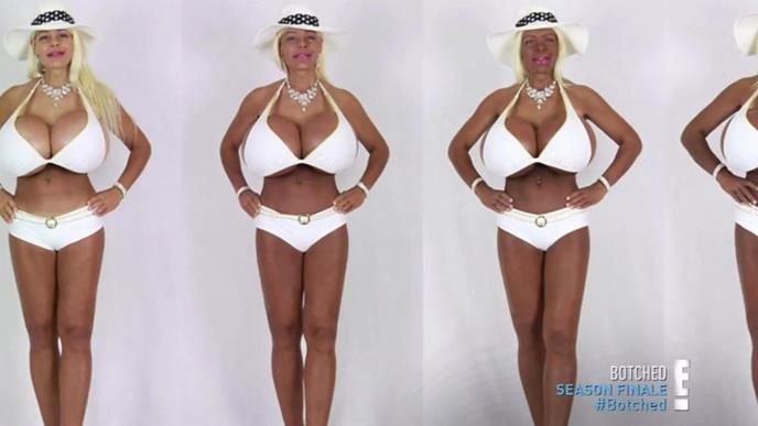 Martina Big nakon operacija profimedia-0378419795.jpg