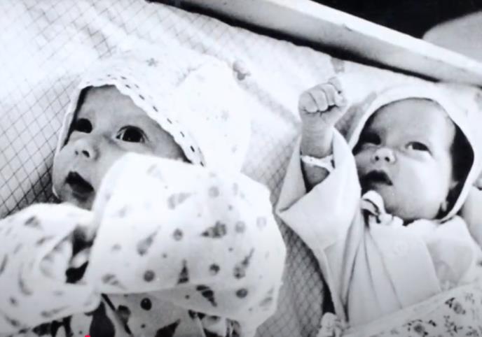 Sijamske bliznakinje Ana i Tanja Korkinova - bebe.jpg
