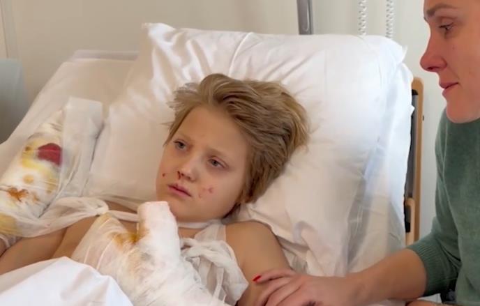 dečaku bomba raznela ruku na ulici