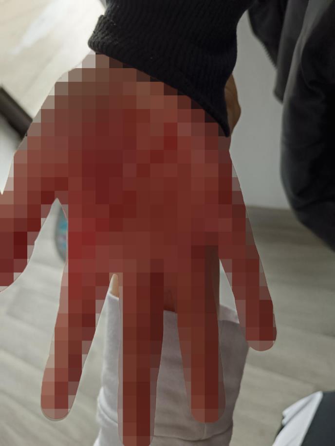 Vlasotince vršnjačko nasilje