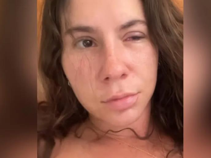 Vivijen Nosovicki - problem sa okom.jpg