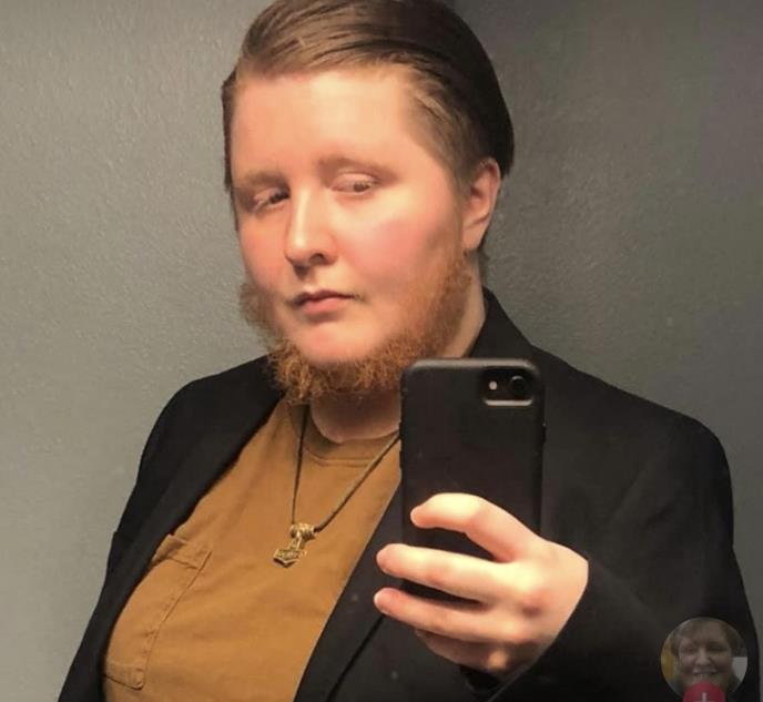 Megan Rajli Nili-Stivenson iz Tenesija ponosno pokazuje bradu koju ima zbog hirsutizma