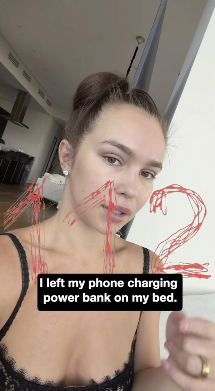 Ana Otavina - zadobila teške opekotine kad joj je tokom noći eksplodirao punjač za telefon